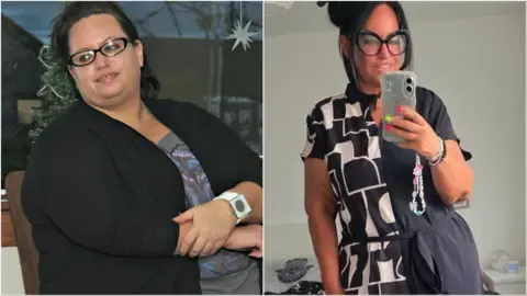 They Lost Weight With Injections – Followed By the Loose Skin