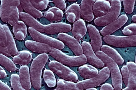 Louisiana Reports Five Deaths from Necrotizing Bacterium in Gulf Waters